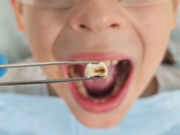 Best Orthodontic Emergency Dentist in Rector, AR