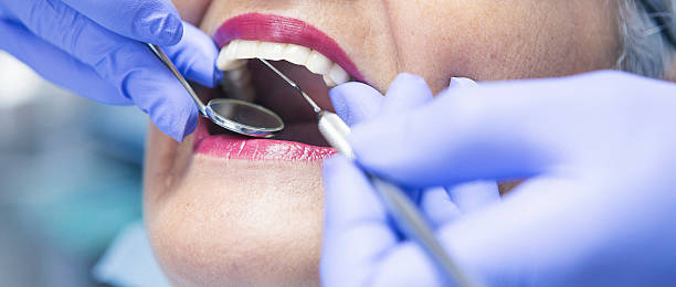 Best Emergency Dentist for Lost Fillings or Crowns in Rector, AR